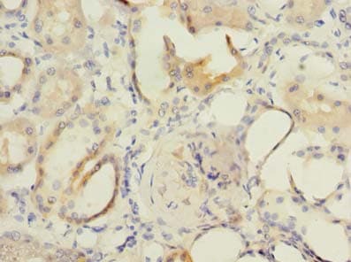FMNL1 Antibody