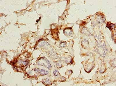MAGEA9 Antibody