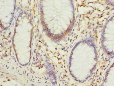 PHF10 Antibody