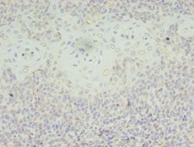 SH3BGRL Antibody