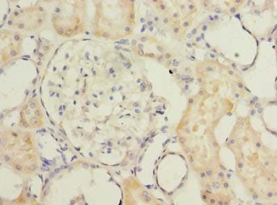 TMEM186 Antibody