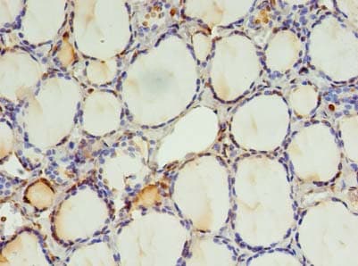 EFCAB14 Antibody