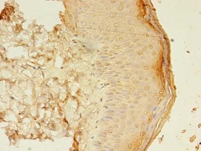 SMAD1 Antibody