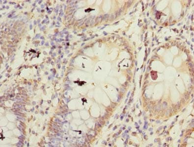 FBXW10 Antibody