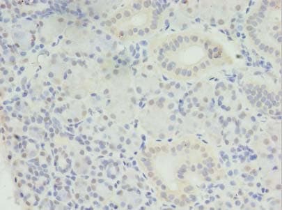 MED30 Antibody