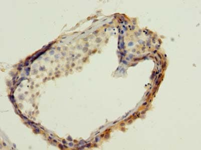 WBP2 Antibody