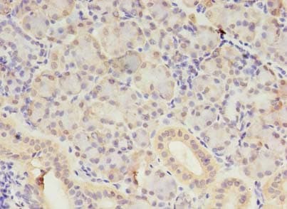 SAMD3 Antibody