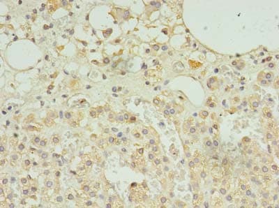 SCAMP5 Antibody