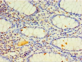 CYP4F12 Antibody (aa265-524)