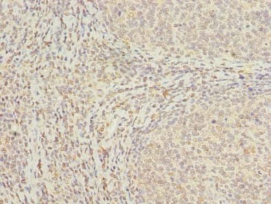 MED18 Antibody