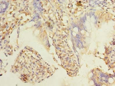 TMEM38B Antibody