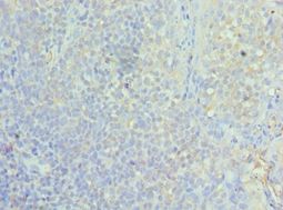 Polyclonal Rabbit anti-Human ASF1A Antibody (aa1-204, IHC, WB)