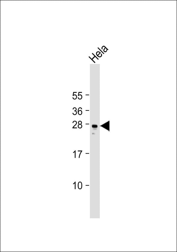 RAB34 Antibody
