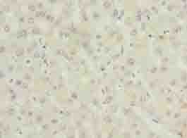 ALAS2 Antibody