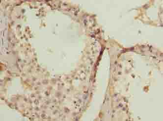 SPCS2 Antibody