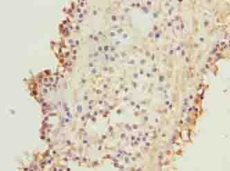 KIF26B Antibody