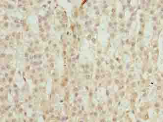 TRAPPC6B Antibody