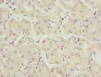 TRAPPC6B Antibody