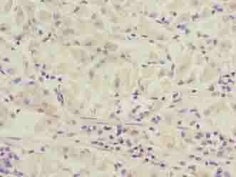 Polyclonal Rabbit anti-Human SLC52A1 / GPR172B / PAR2 Antibody (IHC)