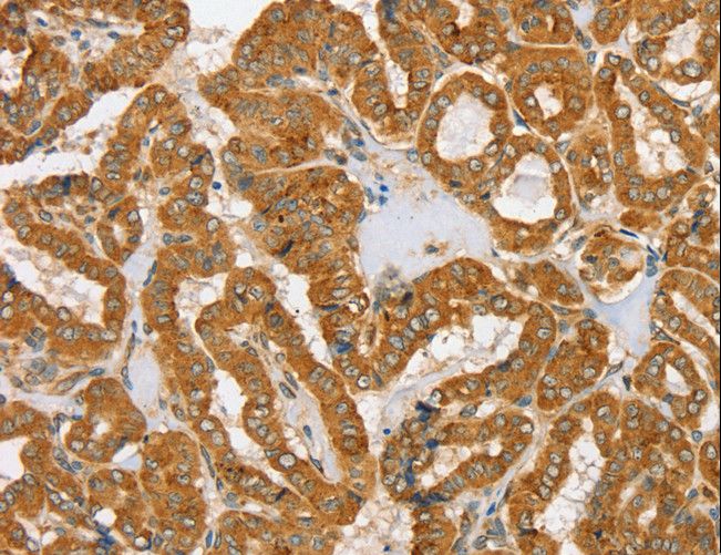 PDP1 Antibody