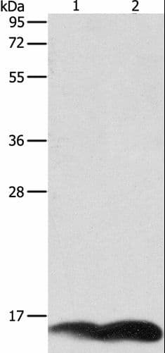 Polyclonal Rabbit anti-Human PFN1 / Profilin 1 Antibody (WB)