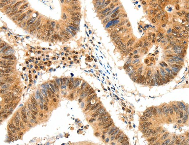 Polyclonal Rabbit anti-Human TERF2 / TRF2 Antibody (IHC)