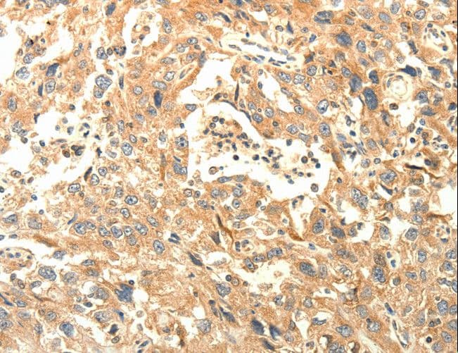Polyclonal Rabbit anti-Human AGRN / Agrin Antibody (IHC)
