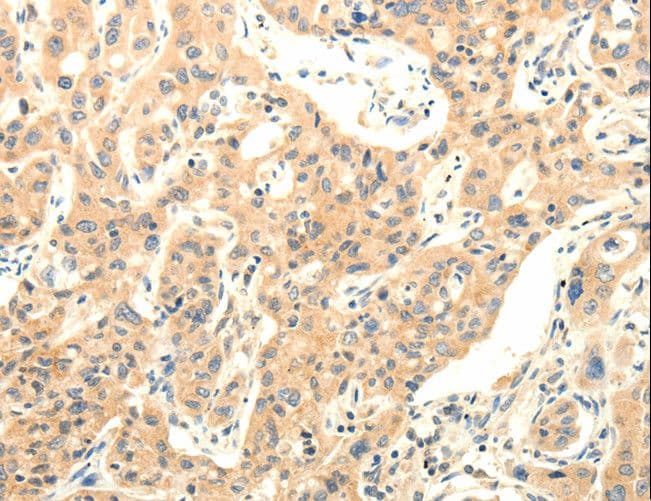 Polyclonal Rabbit anti-Human AGRN / Agrin Antibody (IHC)