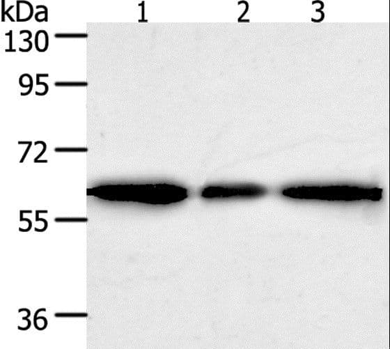 Polyclonal Rabbit anti-Human AKR1A1 Antibody (IHC, WB)