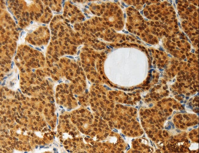 Polyclonal Rabbit anti-Human AKR1A1 Antibody (IHC, WB)