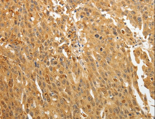Polyclonal Rabbit anti-Human AKR1A1 Antibody (IHC, WB)