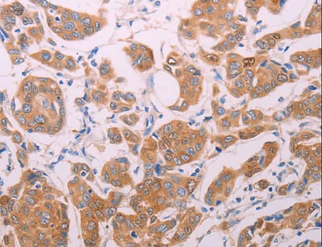 Polyclonal Rabbit anti-Human AGT / Angiotensinogen Antibody (IHC, WB)