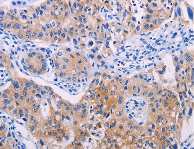 Polyclonal Rabbit anti-Human AGT / Angiotensinogen Antibody (IHC, WB)