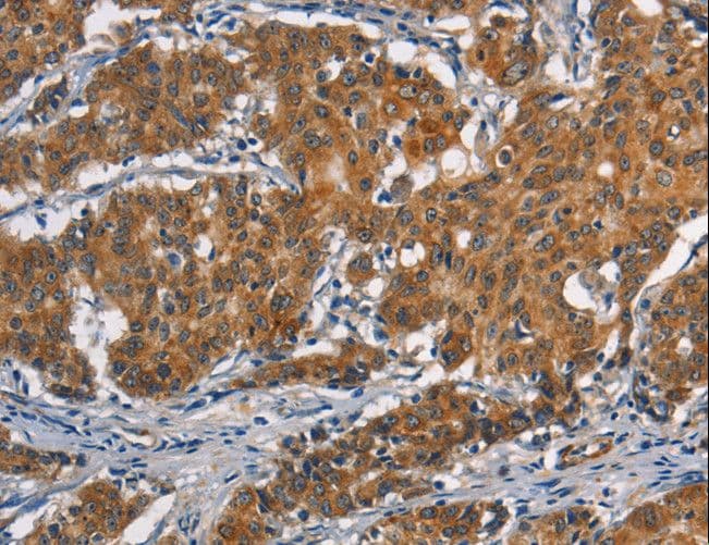 Polyclonal Rabbit anti-Human APOL1 / Apolipoprotein L Antibody (IHC, WB)