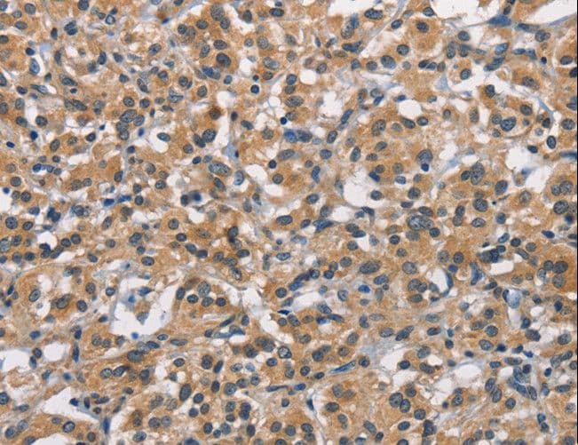 Polyclonal Rabbit anti-Human APOL1 / Apolipoprotein L Antibody (IHC, WB)