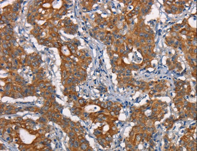 Polyclonal Rabbit anti-Human CDC23 Antibody (IHC)