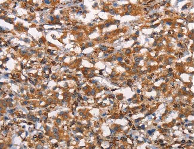 Polyclonal Rabbit anti-Human CDC23 Antibody (IHC)