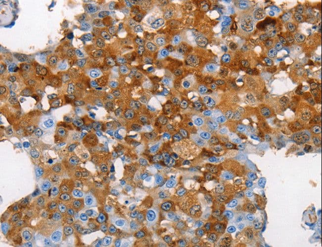 Polyclonal Rabbit anti-Human MUC5B Antibody (IHC)