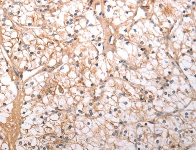 Polyclonal Rabbit anti-Human OX1R / Orexin Receptor 1 Antibody (IHC)