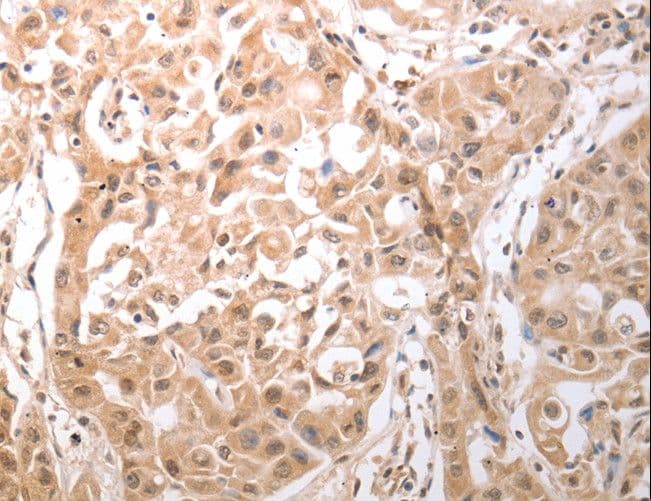 Polyclonal Rabbit anti-Human OX1R / Orexin Receptor 1 Antibody (IHC)