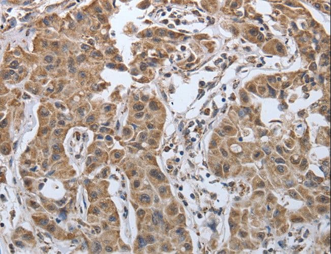 Polyclonal Rabbit anti-Human PDIA2 Antibody (IHC)