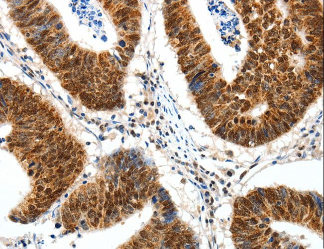 Polyclonal Rabbit anti-Human SP1 Antibody (IHC)