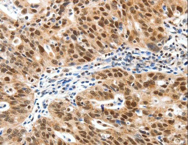 Polyclonal Rabbit anti-Human SP1 Antibody (IHC)