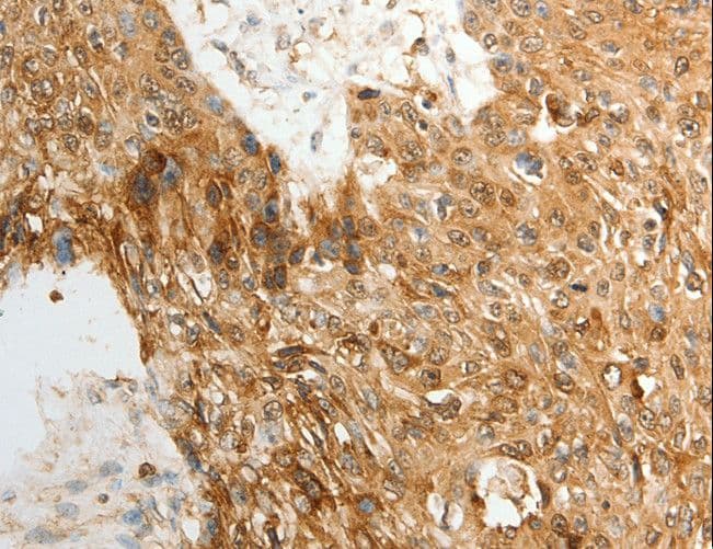 ODZ3 Antibody