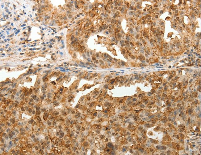 ODZ3 Antibody