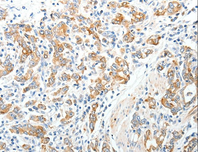 Polyclonal Rabbit anti-Human TP1 / TEP1 Antibody (IHC)