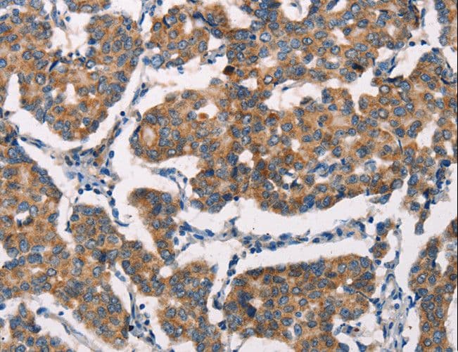 Polyclonal Rabbit anti-Human SPR Antibody (IHC, WB)
