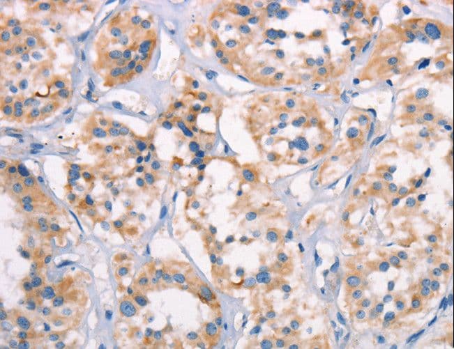 Polyclonal Rabbit anti-Human SPR Antibody (IHC, WB)