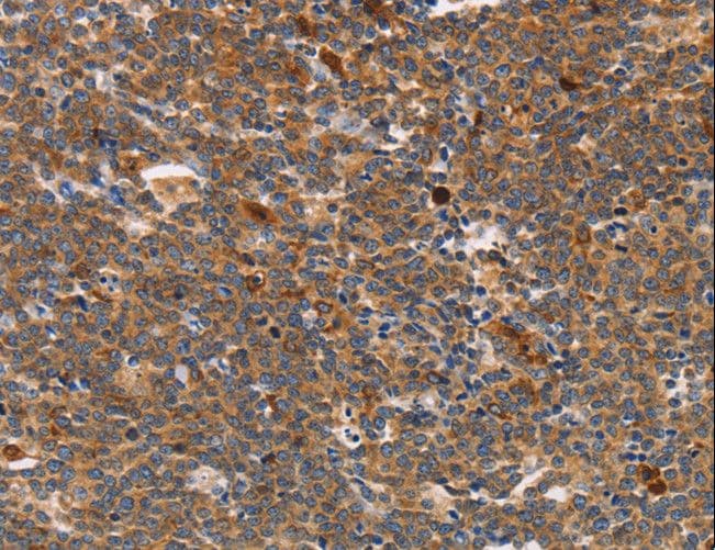 Polyclonal Rabbit anti-Human STK4 Antibody (IHC, WB)