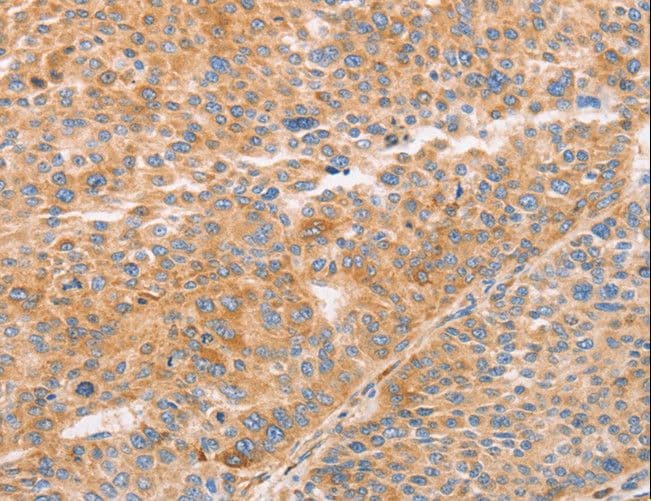 Polyclonal Rabbit anti-Human STK4 Antibody (IHC, WB)